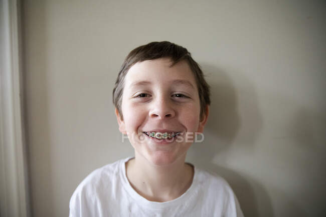 Tween Boy With Red and Green Braces Grins At Camera, Close Up — Stock Photo