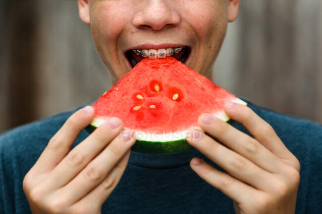 Adolescente menino com aparelho morde em melancia — Fotografia de Stock