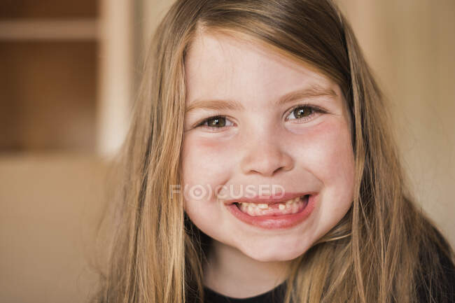 Primo piano di una bocca ragazze con denti mancanti — Foto stock