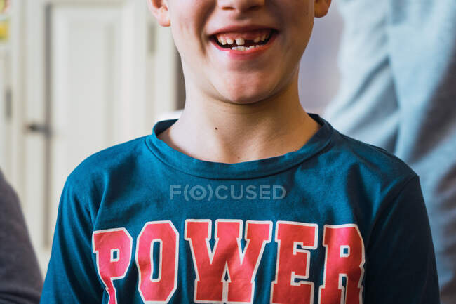 Niño con dientes faltantes sonriendo - foto de stock