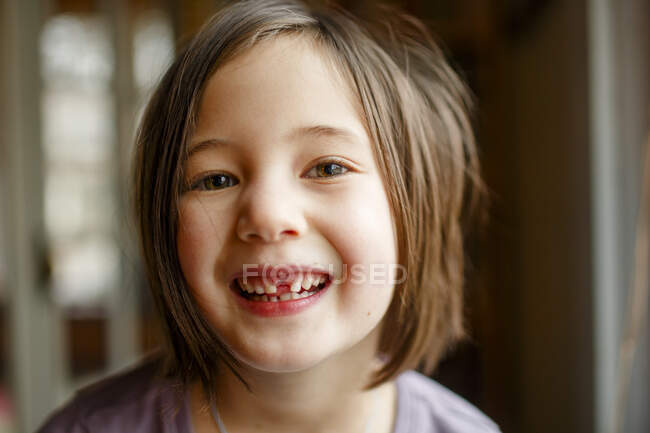 Gros plan de fière petite fille montrant dent manquante avec un grand sourire — Photo de stock