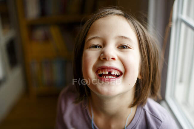 Una ragazza adorabile con gli occhi luminosi mostra orgogliosamente un dente mancante — Foto stock
