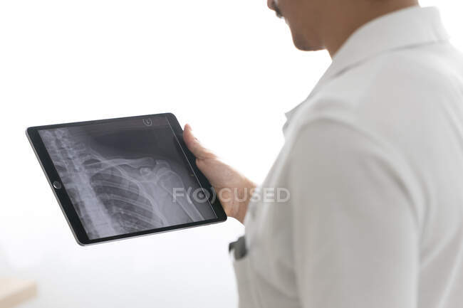 Крупный план мужского реабилитационного профессионального планшета с рентгеном пациента — стоковое фото