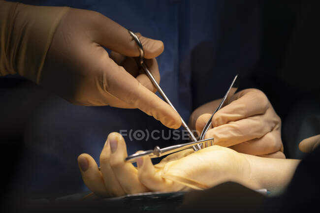 Close-up shot of surgeon operating palm of patient — Stock Photo