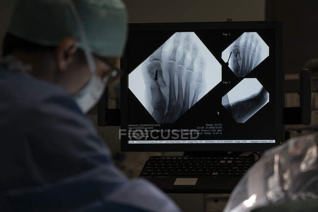 Nahaufnahme des operierenden Chirurgen am Fuß des Patienten — Stockfoto