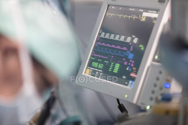 Gros plan du moniteur de fréquence cardiaque en salle d'opération — Photo de stock