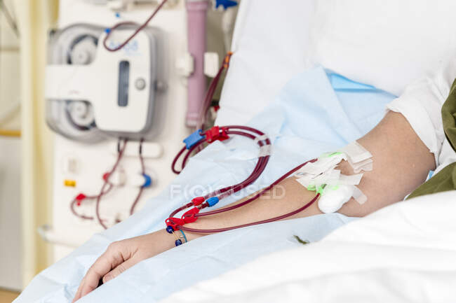 Erschossener Mann erhält Bluttransfusion im Krankenhaus — Stockfoto