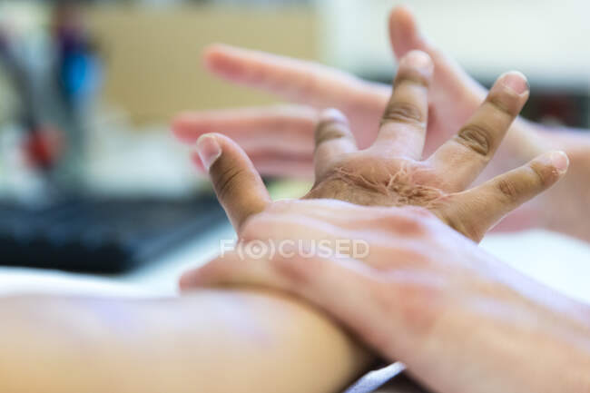 Inyección recortada del médico que examina la mano lesionada del niño - foto de stock