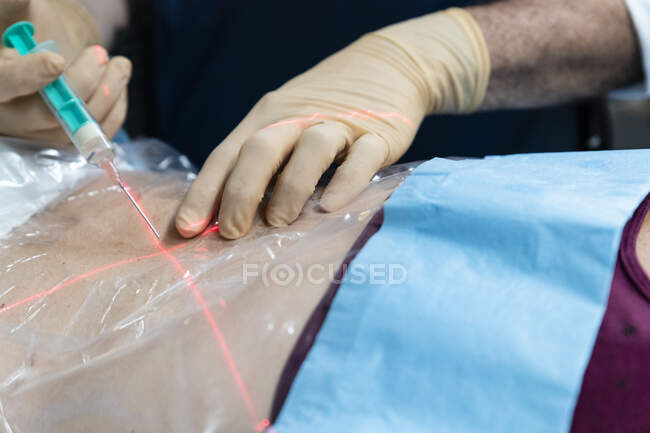 Close-up tiro do médico realizando punção com agulha e laser cruz no corpo da mulher — Fotografia de Stock