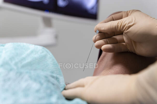 Gros plan du médecin pratiquant la ponction avec aiguille et croix laser sur le corps de la femme — Photo de stock