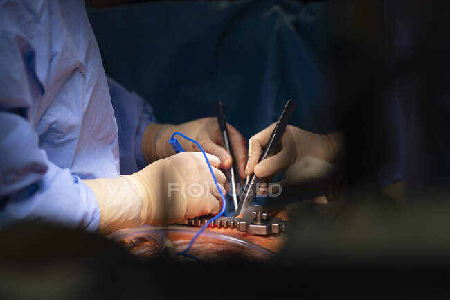 Tiro recortado dos cirurgiões que executam a operação — Fotografia de Stock