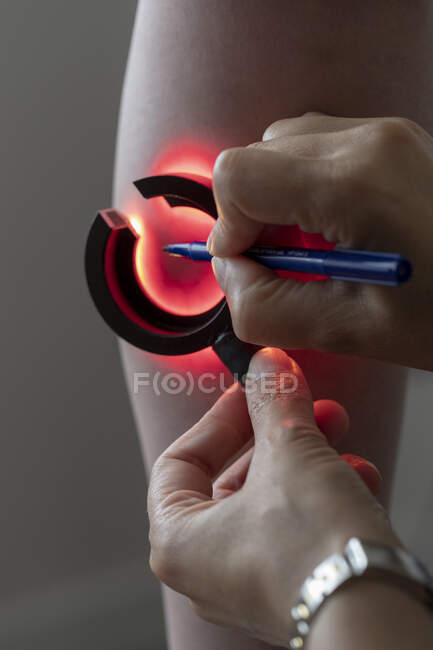 Primer plano de las manos del médico que sostiene la linterna en la pierna del paciente para examinar sus vasos - foto de stock