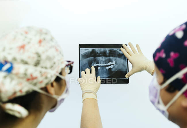 Dentiste étudiant une radiographie avant d'opérer — Photo de stock