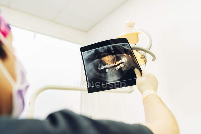 Стоматолог, який спостерігає за рентгенівським випромінюванням перед операцією — стокове фото