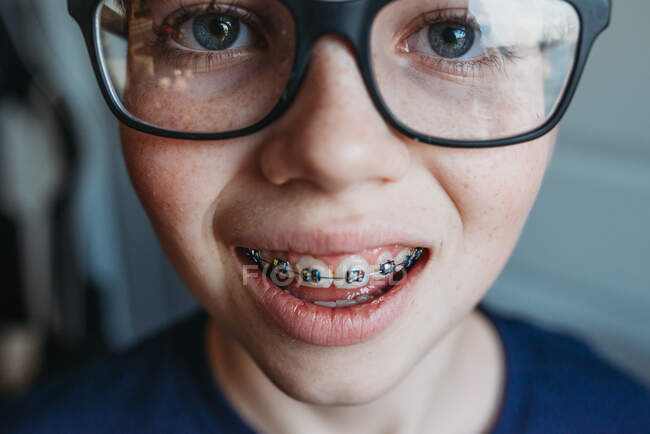 Primer plano de joven adolescente con gafas y aparatos ortopédicos - foto de stock