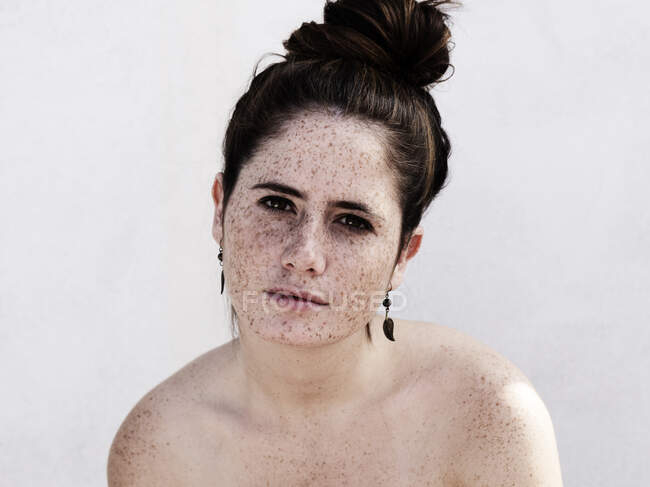 Дівчина з веснянками на обличчі та тілі — стокове фото