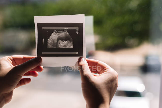 Les mains de la femme tenant une échographie de son bébé. Fenêtre et rue en arrière-plan. — Photo de stock