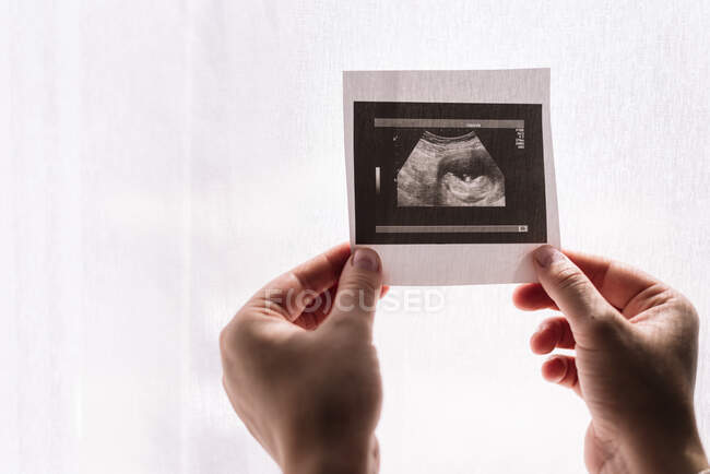 Manos de mujer sosteniendo un ultrasonido de su bebé. Fondo de tela blanca - foto de stock