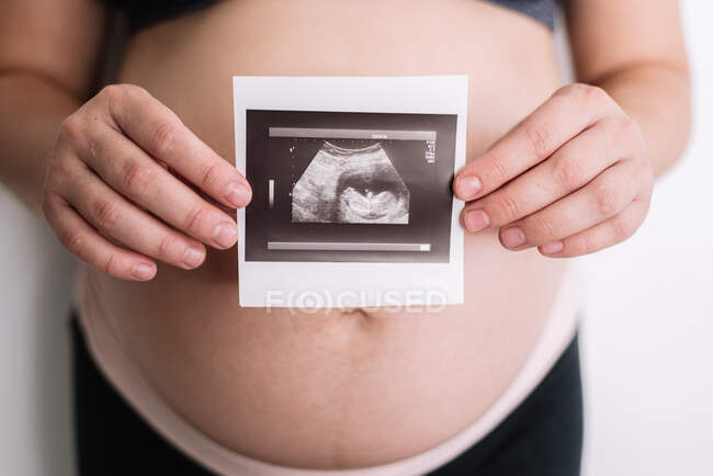 Pregnant woman holding an ultrasound of her baby. — Stock Photo