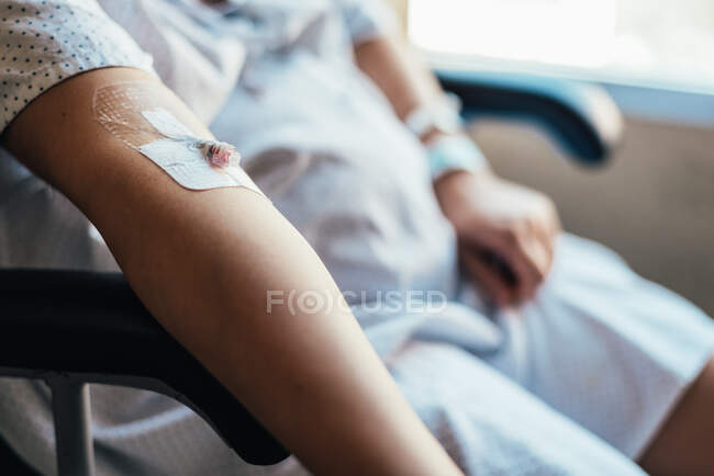 Nahaufnahme einer intravenösen Linie im Arm eines Patienten. — Stockfoto