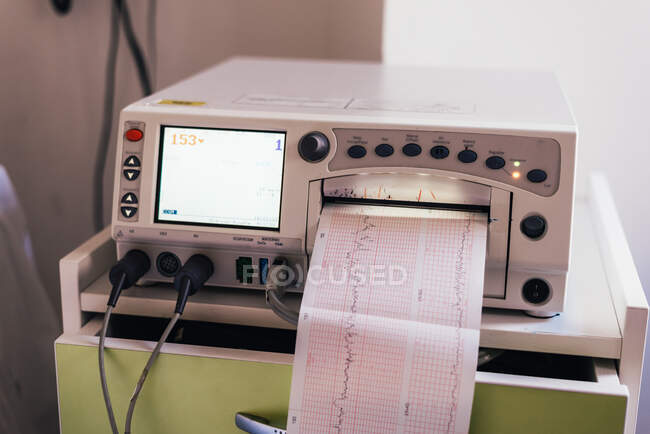 Machine de surveillance de la grossesse. Graphique en temps réel de la fréquence cardiaque du bébé. — Photo de stock
