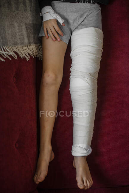 Cast su gamba di ragazzo sdraiato sul divano — Foto stock