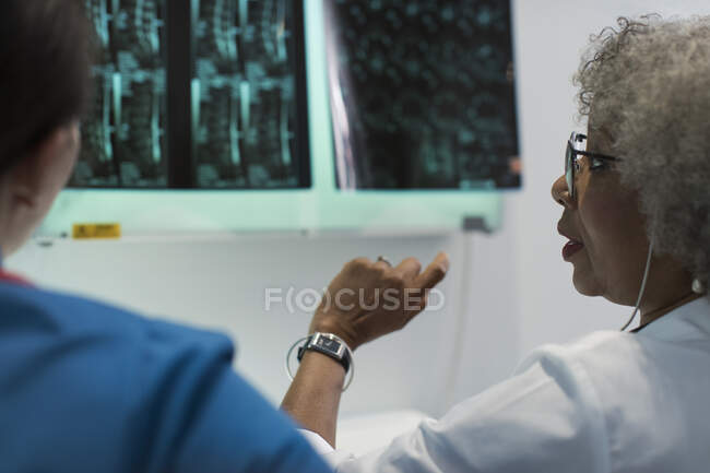 Médicas discutindo raios-x no hospital — Fotografia de Stock