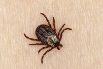 Wood tick on person skin, close-up — Stock Photo