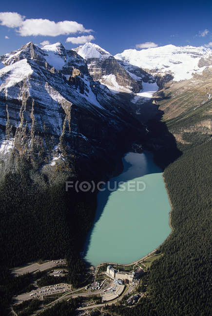 Luftaufnahme des Louise-Sees in den Bergen des Banff-Nationalparks, Alberta, Kanada. — Stockfoto