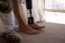 Unterteil der Frau mit Beinprothese im Schlafzimmer zu Hause. — Stockfoto