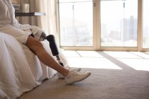 Інвалід жінка з протезною ногою сидить у спальні вдома . — стокове фото