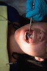 Nahaufnahme eines männlichen Zahnarztes bei der Untersuchung einer Patientin in einer Klinik — Stockfoto