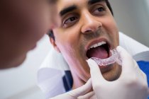 Стоматолог, помогающий пациенту носить ортодонтические силиконовые невидимые брекеты — стоковое фото