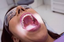 Жіночий пацієнт, який отримує легке лікування зубів у стоматологічній клініці, крупним планом — стокове фото
