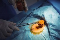 Хірург, що виконує операцію в операційному театрі в лікарні — стокове фото