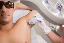 Doctor performing laser hair removal on male patient armpit skin in clinic — Stock Photo