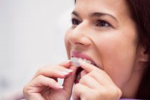 Paziente donna che indossa l'apparecchio in clinica dentale — Foto stock