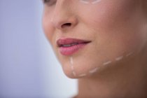 Ritratto di donna adulta con segni per il trattamento cosmetico — Foto stock