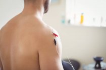Close-up de paciente do sexo masculino recebendo agulha electro seco no ombro — Fotografia de Stock