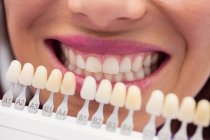 Dentiste examinant patiente avec des nuances de dents à la clinique dentaire — Photo de stock