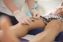Physiotherapist performing electro dry needling on knee of patient in clinic — Stock Photo