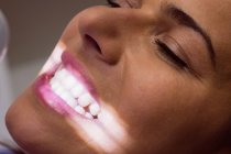 Paciente do sexo feminino recebendo tratamento com luz dentária na clínica odontológica, close-up — Fotografia de Stock