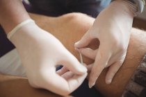 Nahaufnahme des Physiotherapeuten, der trockene Nadeln am Knie des Patienten durchführt — Stockfoto