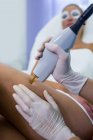 Paciente do sexo feminino em tratamento com laser epilation na perna no salão de beleza — Fotografia de Stock