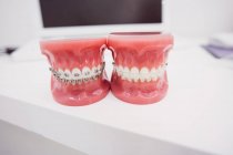 Nahaufnahme von Zahnmodellen in der Zahnklinik — Stockfoto