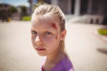 Retrato de niña lesionada en la calle - foto de stock