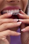 Крупный план пациентки в брекетах с руками в стоматологической клинике — стоковое фото