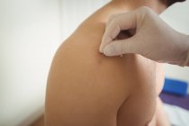Nahaufnahme des Physiotherapeuten, der trockene Nadeln an der Schulter des Patienten in der Klinik durchführt — Stockfoto