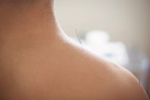 Gros plan du patient masculin qui se sèche à l'épaule — Photo de stock