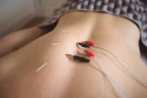 Close-up of patient getting electro dry needling on back in clinic — Stock Photo